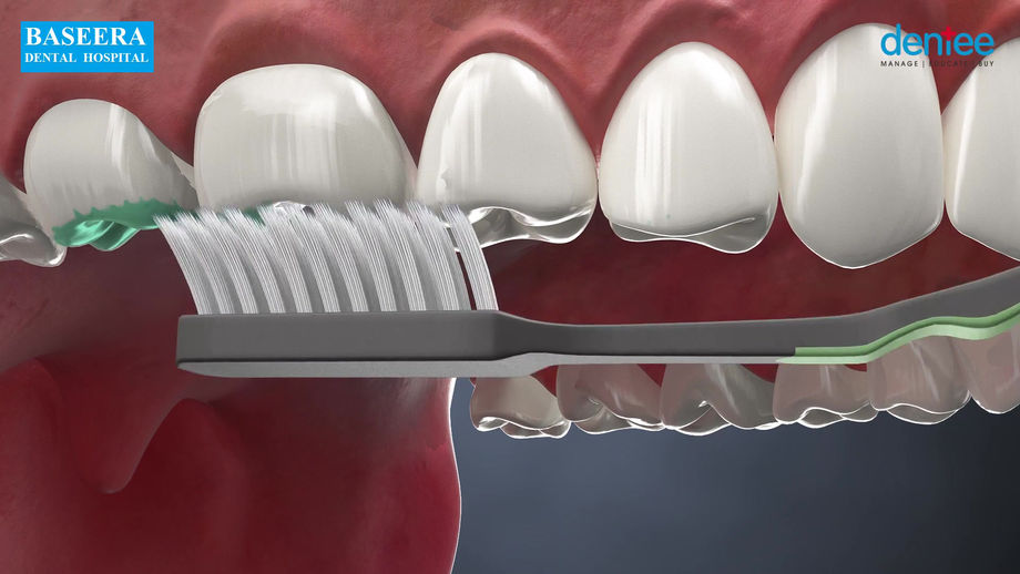 Teethbrushing-technique